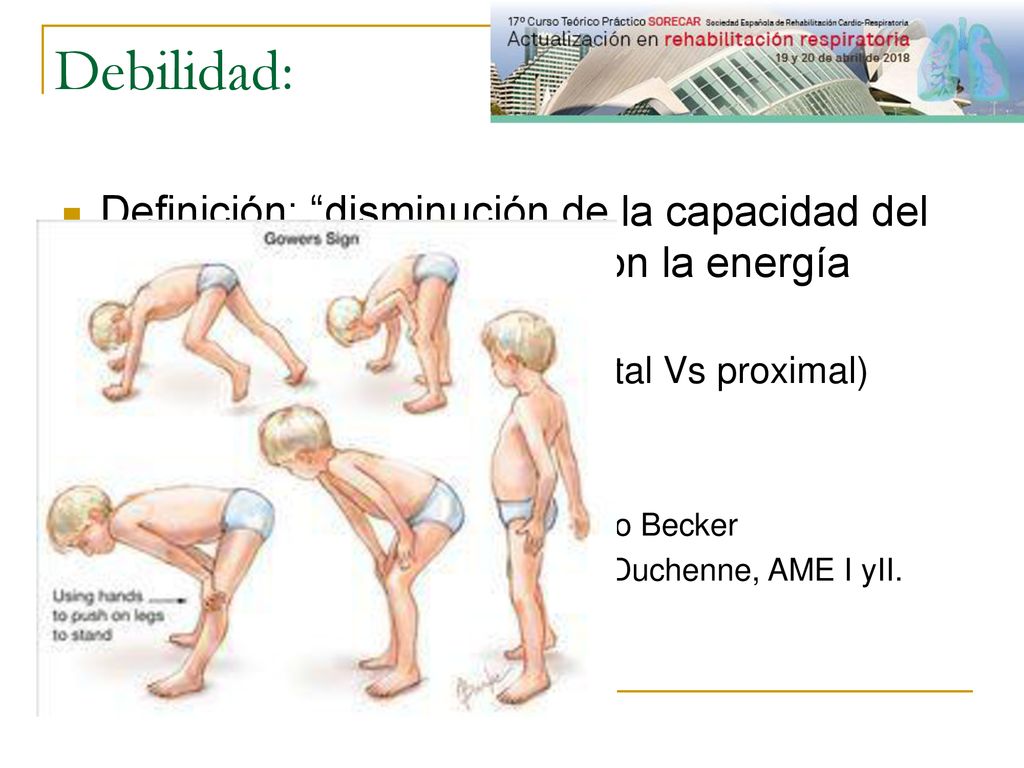 Debilidad: Definición: disminución de la capacidad del músculo para contraerse con la energía adecuada