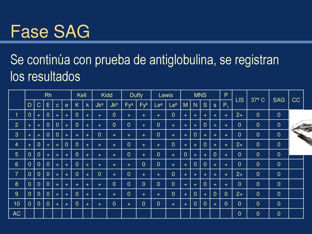 Fase SAG Se continúa con prueba de antiglobulina, se registran los resultados. Rh. Kell. Kidd. Duffy.