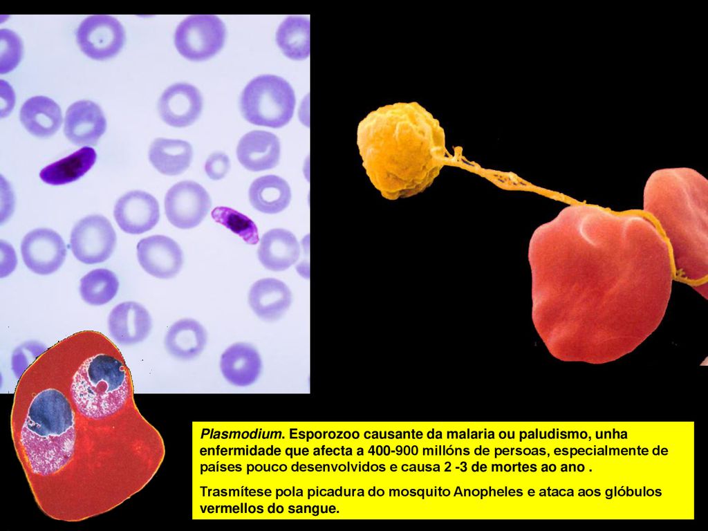 Plasmodium. Esporozoo causante da malaria ou paludismo, unha enfermidade que afecta a millóns de persoas, especialmente de países pouco desenvolvidos e causa 2 -3 de mortes ao ano .