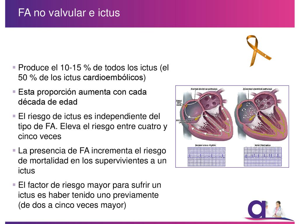 FA no valvular e ictus Produce el % de todos los ictus (el 50 % de los ictus cardioembólicos)