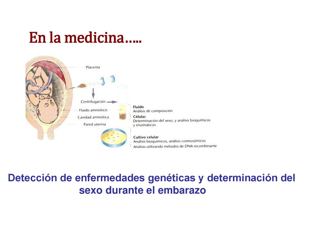 En la medicina….. Detección de enfermedades genéticas y determinación del sexo durante el embarazo