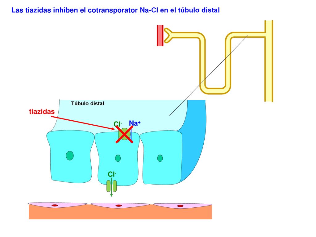 Las tiazidas inhiben el cotransporator Na-Cl en el túbulo distal