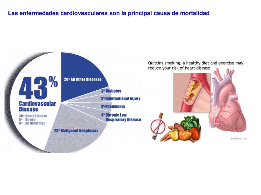 Las enfermedades cardiovasculares son la principal causa de mortalidad