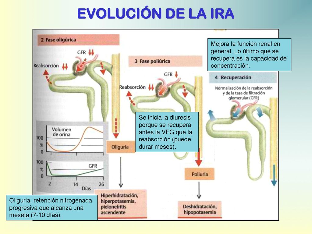 EVOLUCIÓN DE LA IRA Mejora la función renal en general. Lo último que se recupera es la capacidad de concentración.