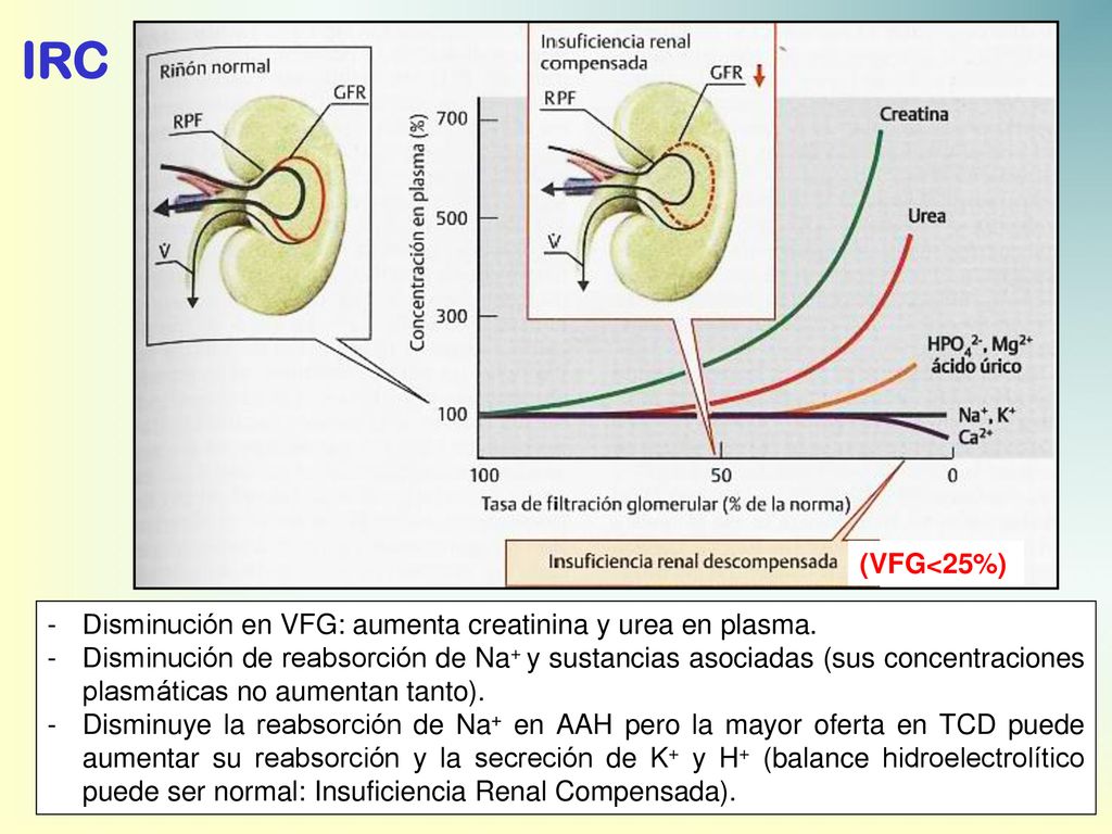 IRC (VFG<25%) Disminución en VFG: aumenta creatinina y urea en plasma.