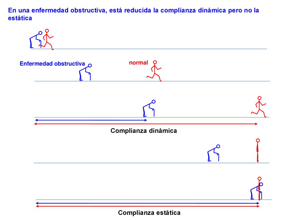 En una enfermedad obstructiva, está reducida la complianza dinámica pero no la estática