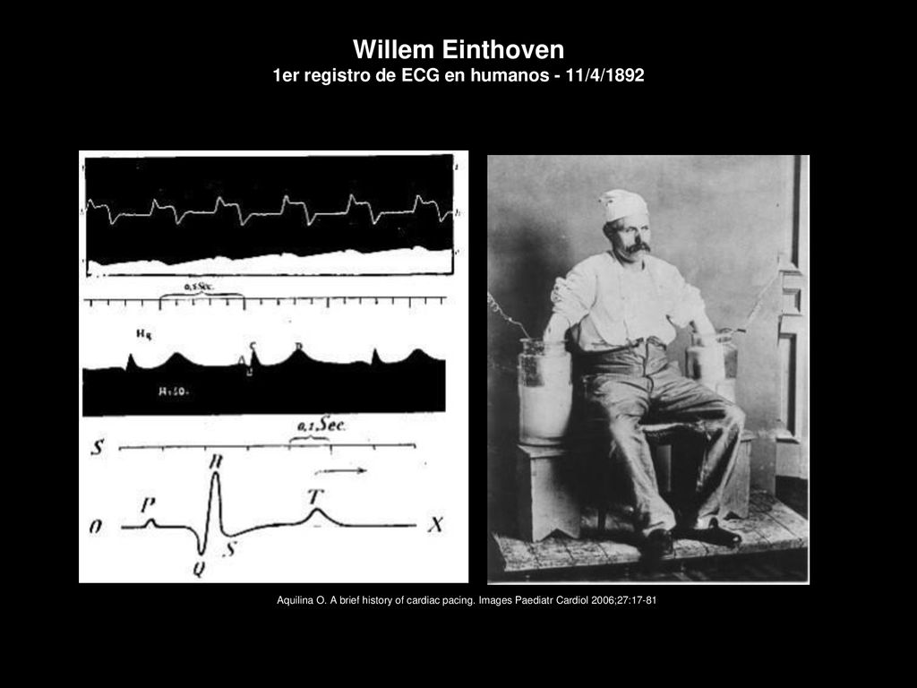 Willem Einthoven 1er registro de ECG en humanos - 11/4/1892