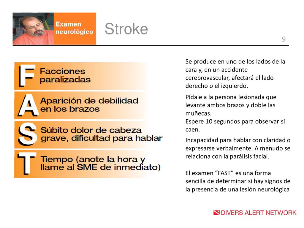 Stroke Se produce en uno de los lados de la cara y, en un accidente cerebrovascular, afectará el lado derecho o el izquierdo.