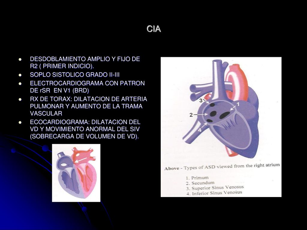 CIA DESDOBLAMIENTO AMPLIO Y FIJO DE R2 ( PRIMER INDICIO).