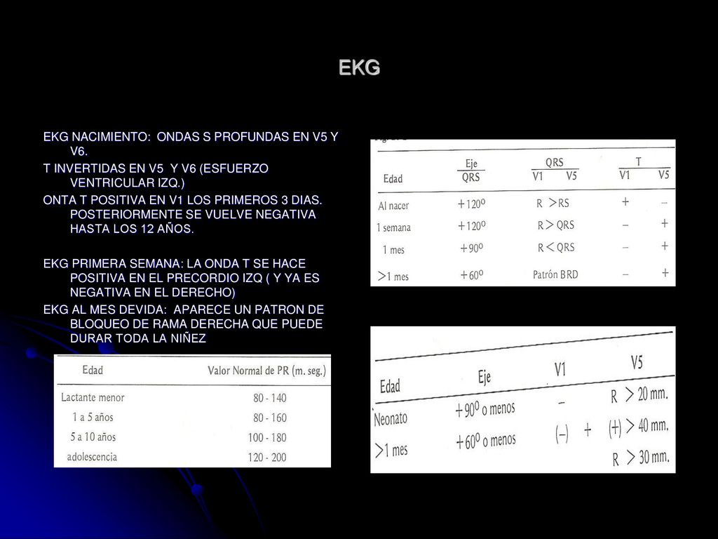 EKG EKG NACIMIENTO: ONDAS S PROFUNDAS EN V5 Y V6.