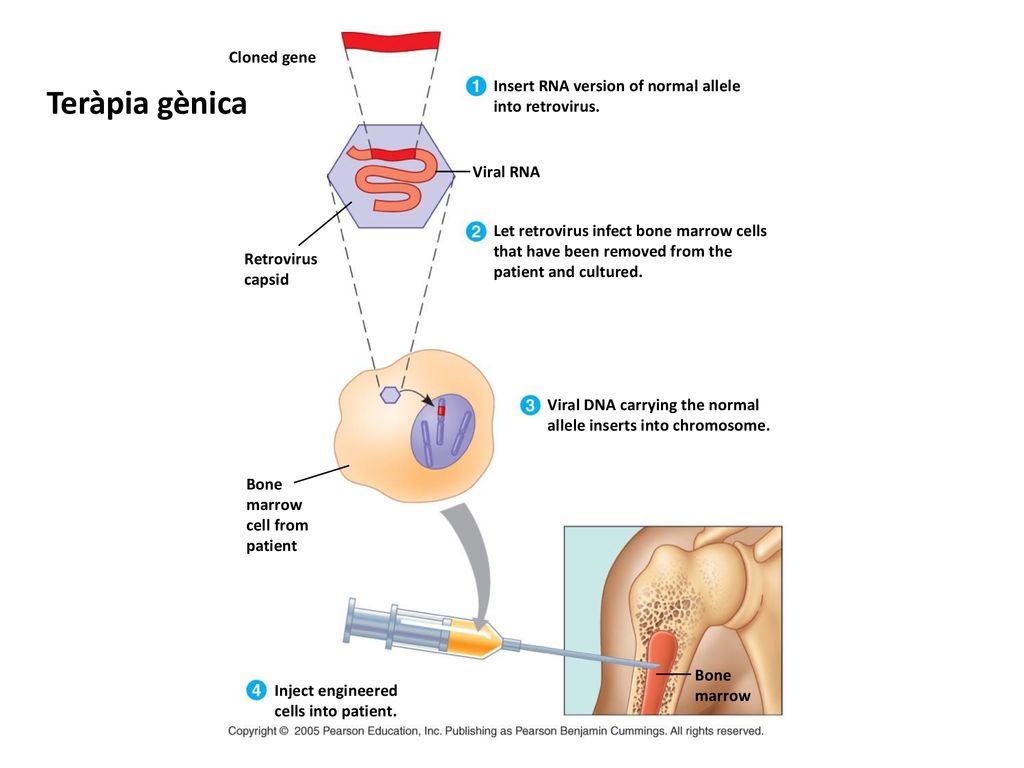 Teràpia gènica Cloned gene Insert RNA version of normal allele