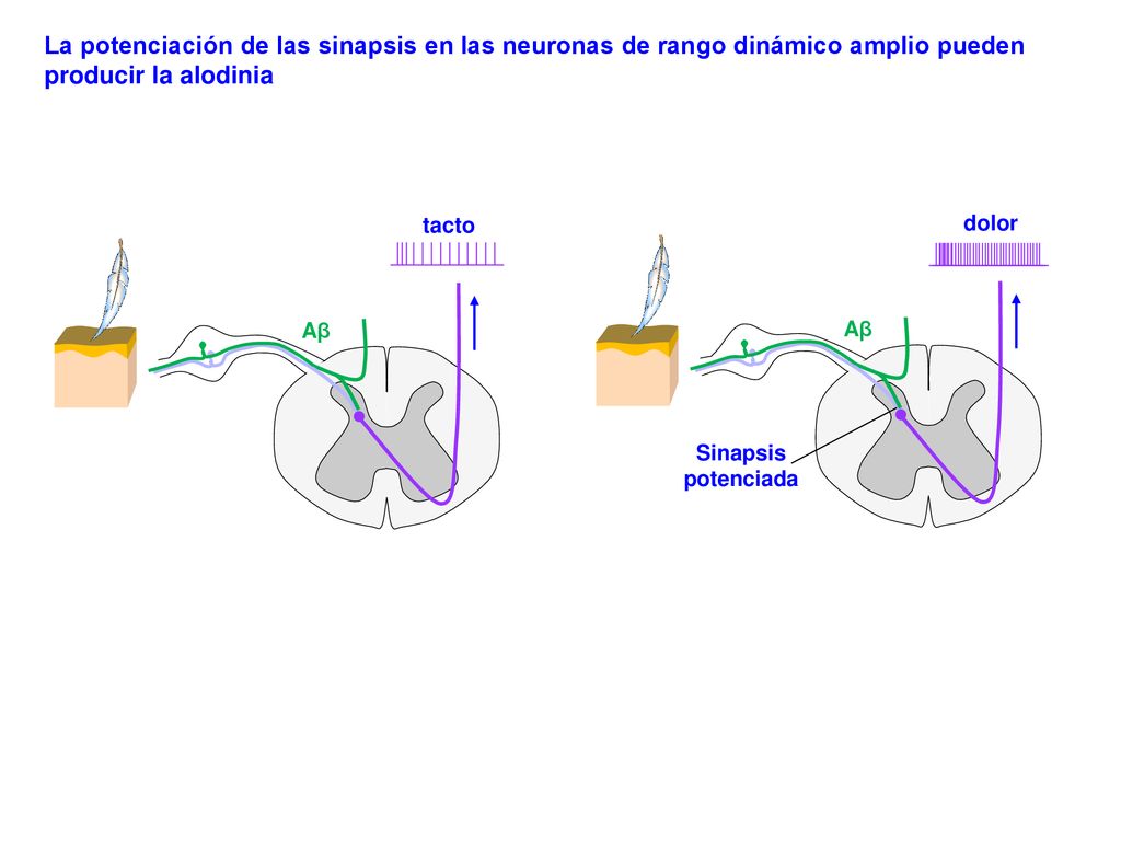 La potenciación de las sinapsis en las neuronas de rango dinámico amplio pueden producir la alodinia