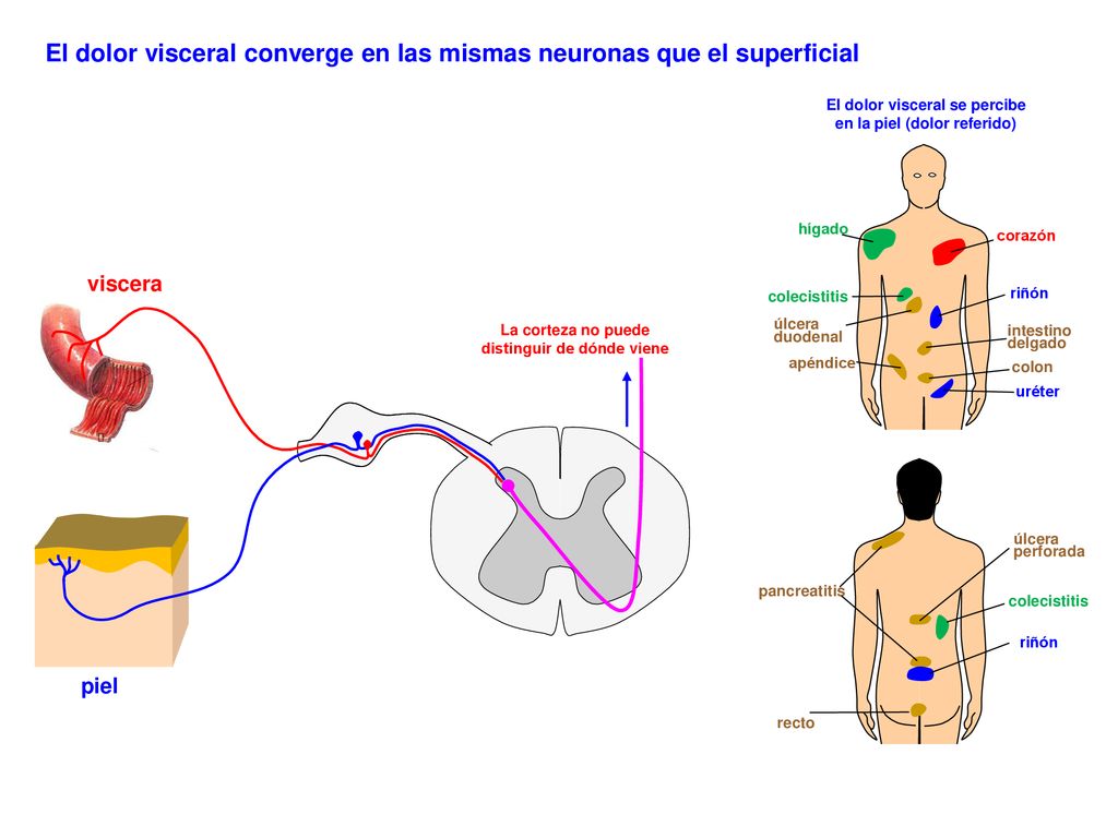 El dolor visceral converge en las mismas neuronas que el superficial