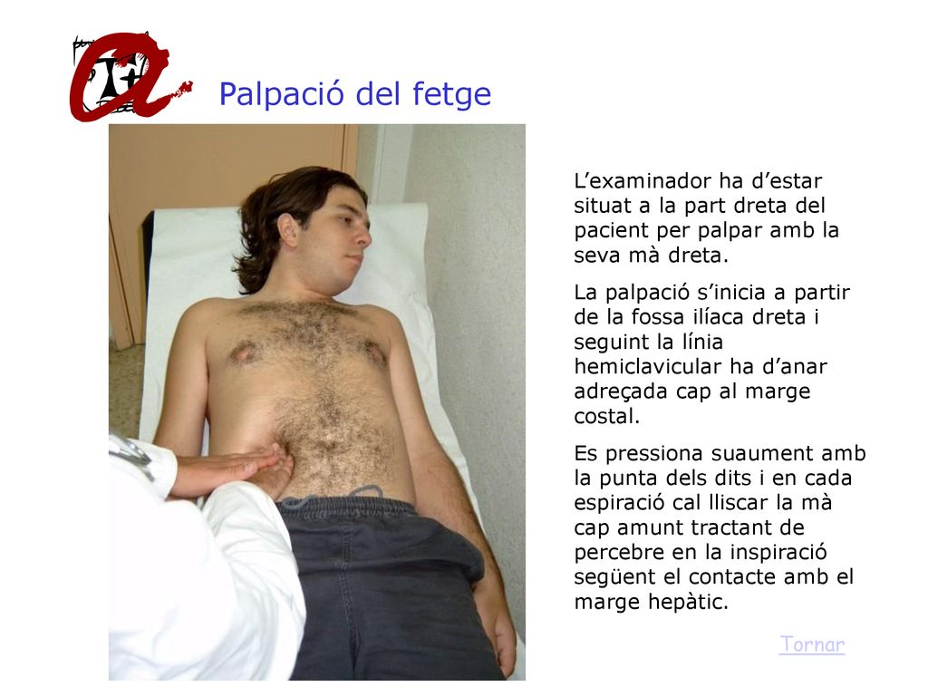 Palpació del fetge L’examinador ha d’estar situat a la part dreta del pacient per palpar amb la seva mà dreta.