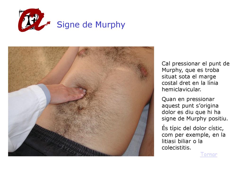 Signe de Murphy Cal pressionar el punt de Murphy, que es troba situat sota el marge costal dret en la línia hemiclavicular.