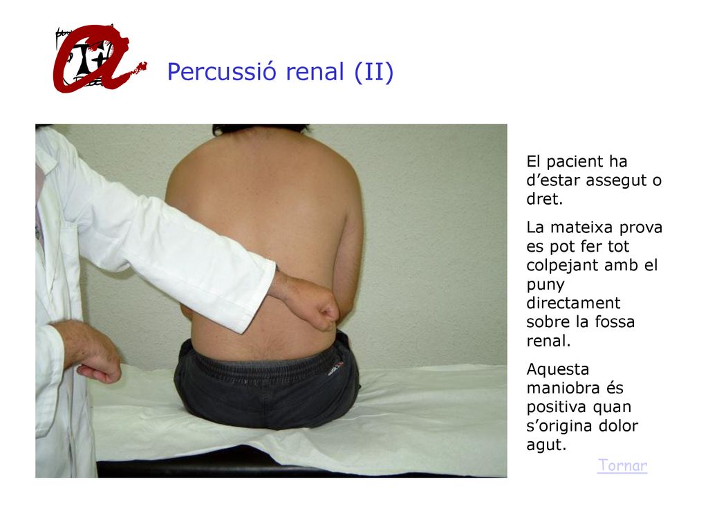 Percussió renal (II) El pacient ha d’estar assegut o dret.