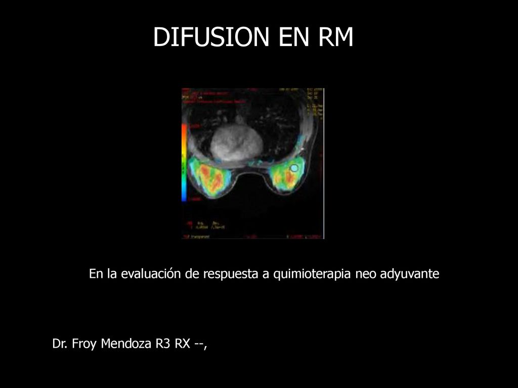 DIFUSION EN RM En la evaluación de respuesta a quimioterapia neo adyuvante.