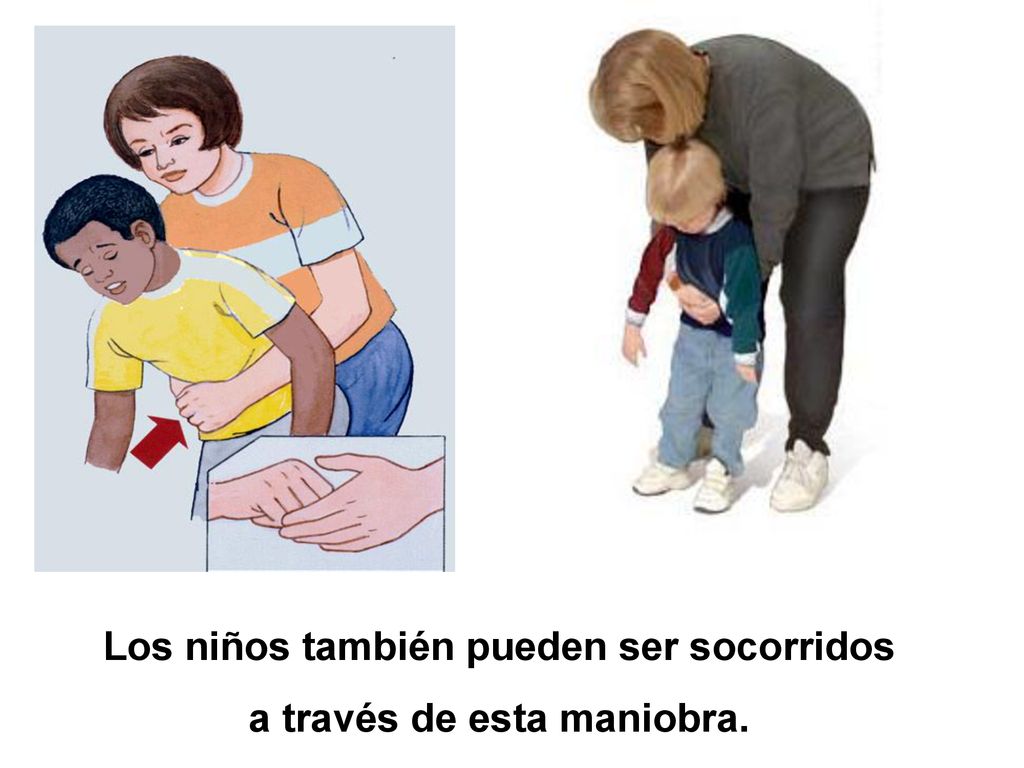 Los niños también pueden ser socorridos a través de esta maniobra.