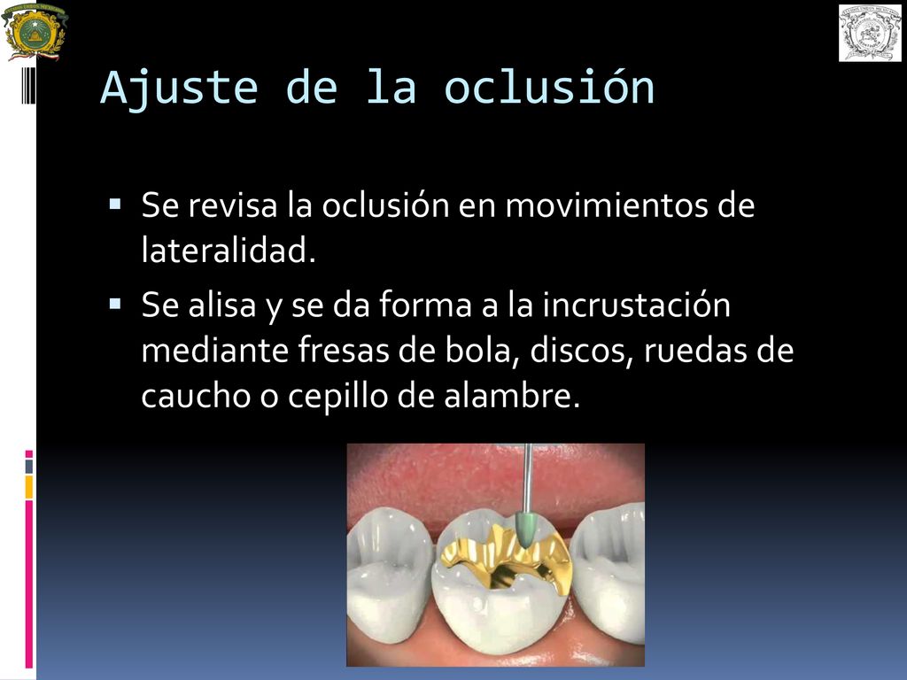 Ajuste de la oclusión Se revisa la oclusión en movimientos de lateralidad.