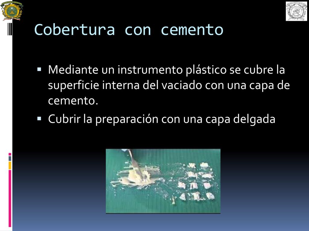 Cobertura con cemento Mediante un instrumento plástico se cubre la superficie interna del vaciado con una capa de cemento.