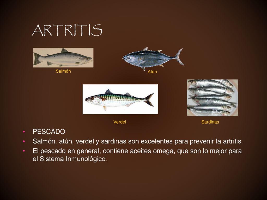 ARTRITIS Salmón. Atún. Verdel. Sardinas. PESCADO. Salmón, atún, verdel y sardinas son excelentes para prevenir la artritis.