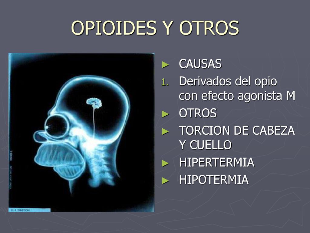 OPIOIDES Y OTROS CAUSAS Derivados del opio con efecto agonista M OTROS