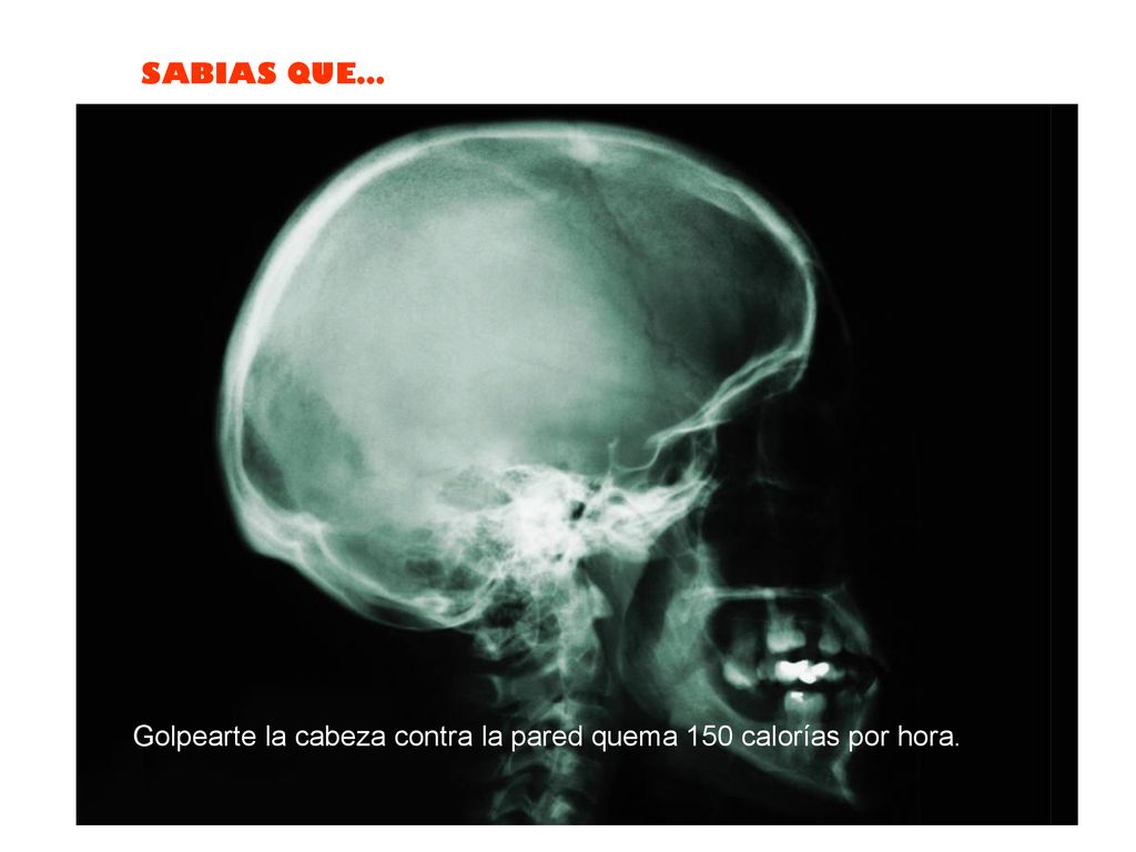 Golpearte la cabeza contra la pared quema 150 calorías por hora.