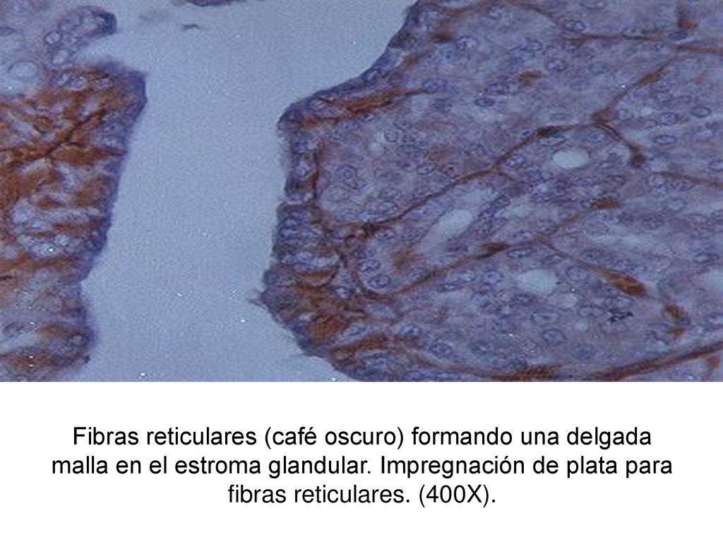 Fibras reticulares (café oscuro) formando una delgada malla en el estroma glandular.