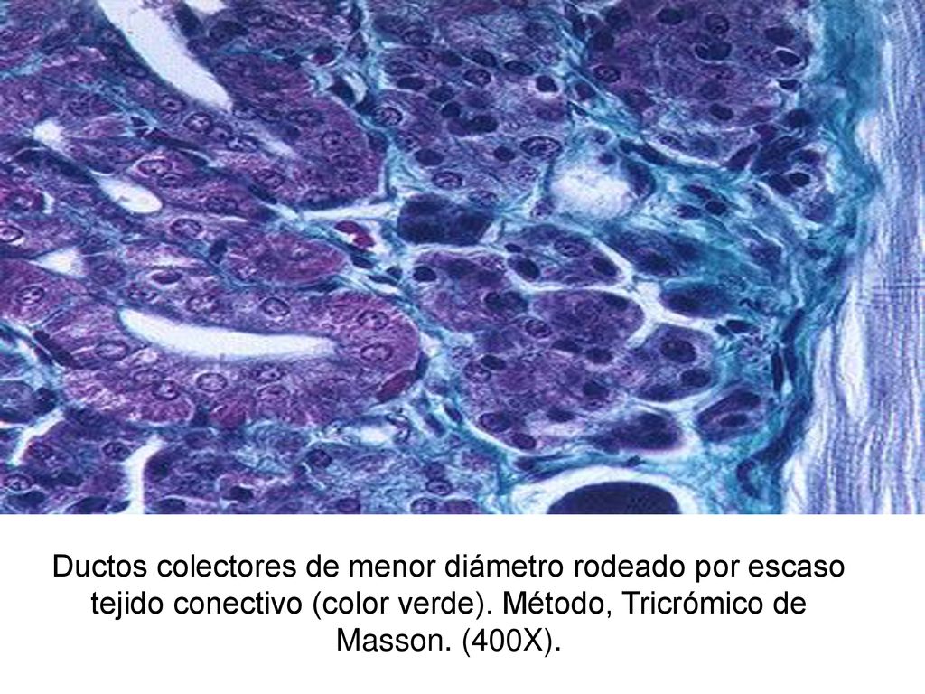 Ductos colectores de menor diámetro rodeado por escaso tejido conectivo (color verde).