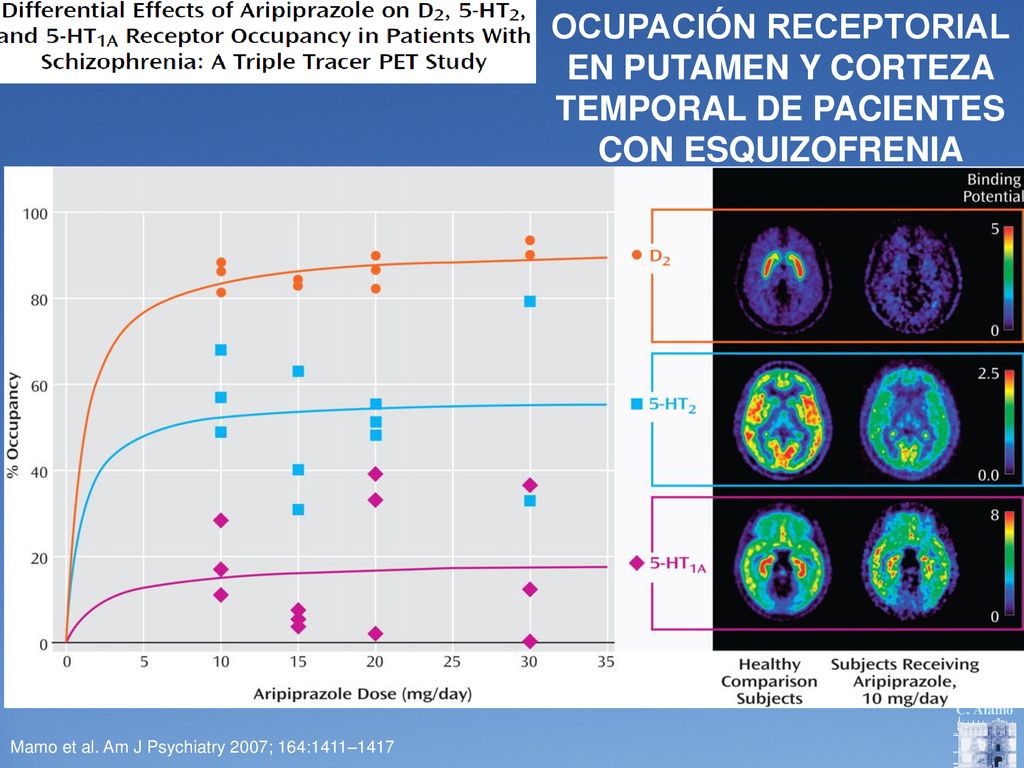 OCUPACIÓN RECEPTORIAL EN PUTAMEN Y CORTEZA TEMPORAL DE PACIENTES CON ESQUIZOFRENIA