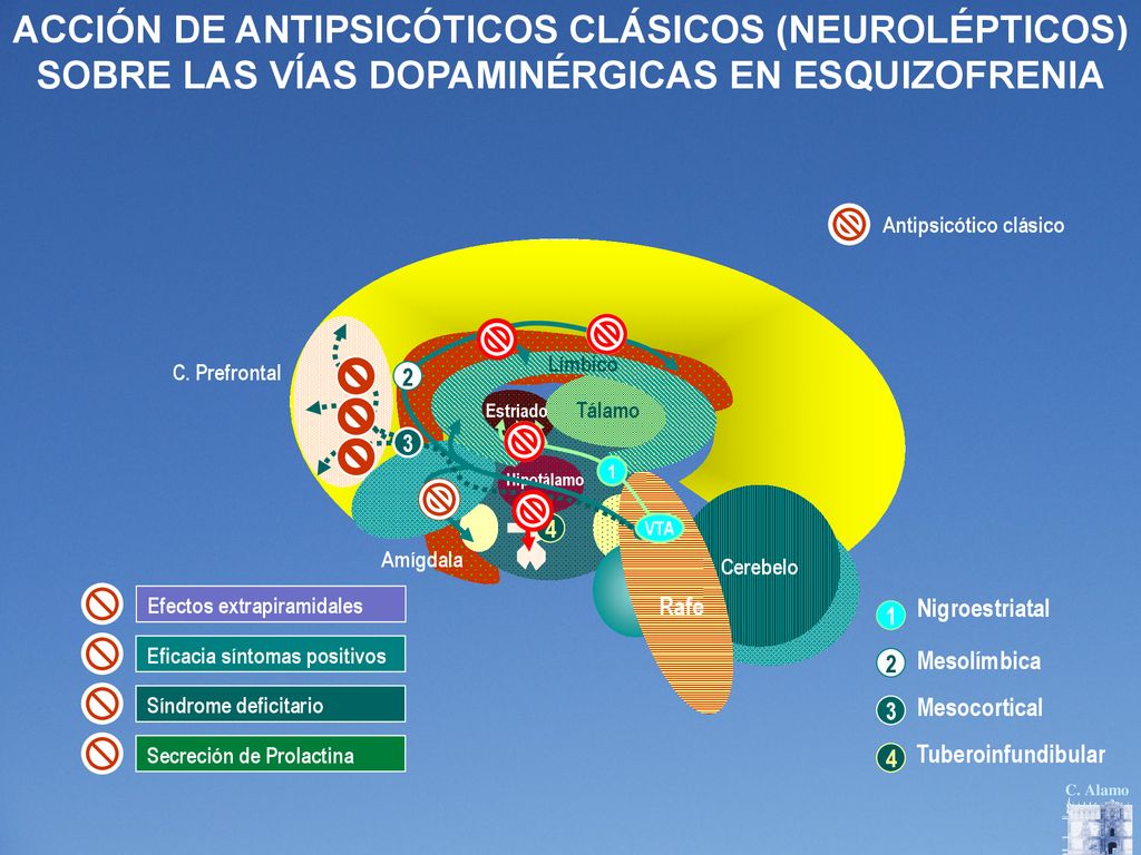 ACCIÓN DE ANTIPSICÓTICOS CLÁSICOS (NEUROLÉPTICOS) SOBRE LAS VÍAS DOPAMINÉRGICAS EN ESQUIZOFRENIA