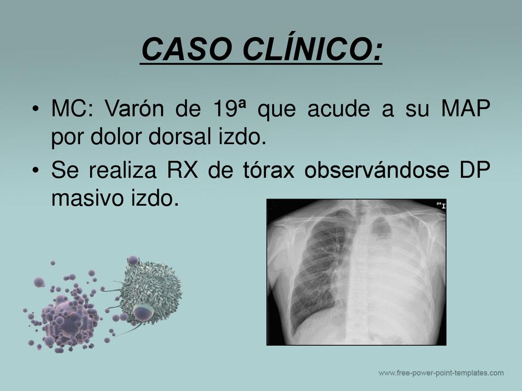 CASO CLÍNICO: MC: Varón de 19ª que acude a su MAP por dolor dorsal izdo.