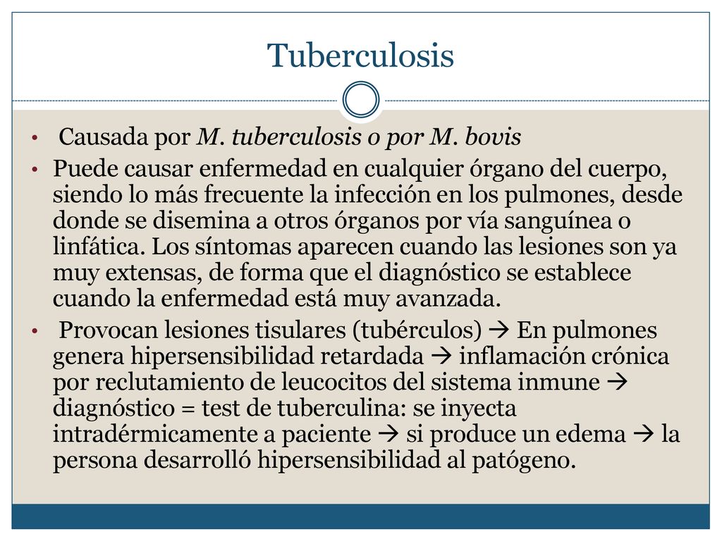 Tuberculosis Causada por M. tuberculosis o por M. bovis