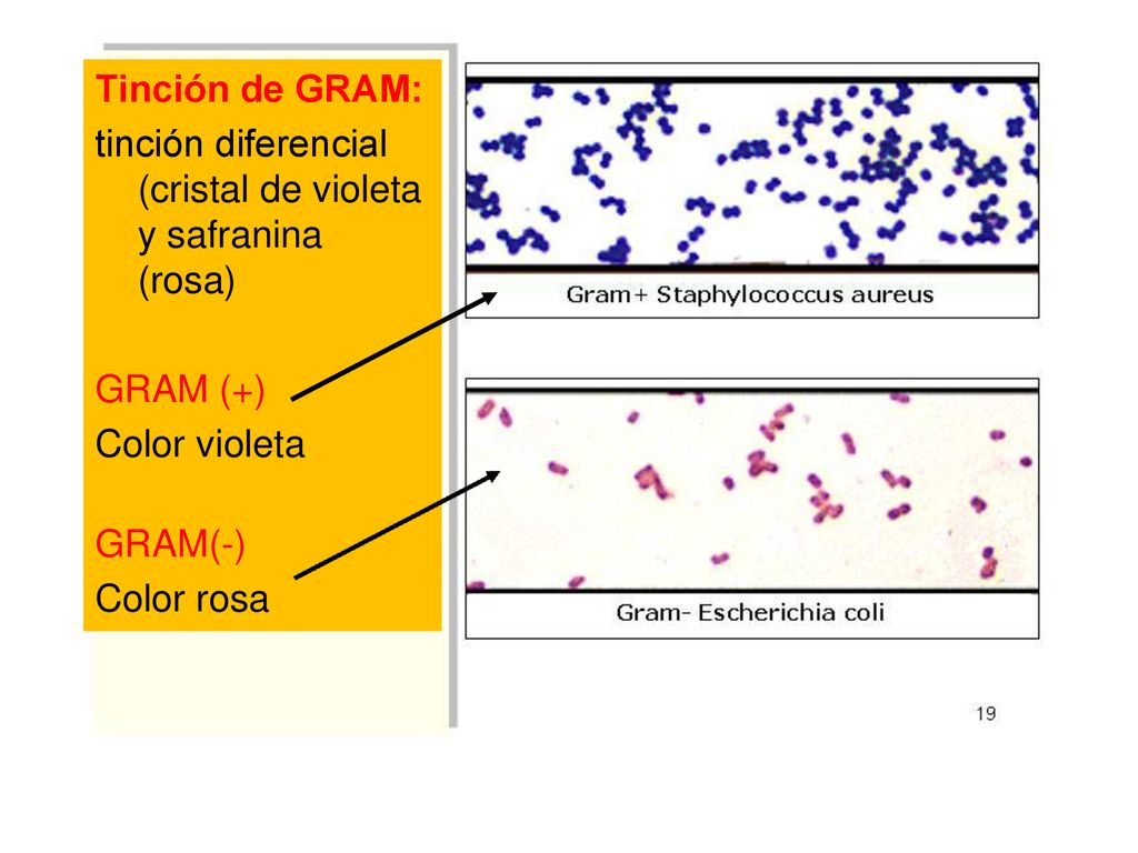 Tinción de GRAM: tinción diferencial (cristal de violeta y safranina (rosa) GRAM (+) Color violeta.
