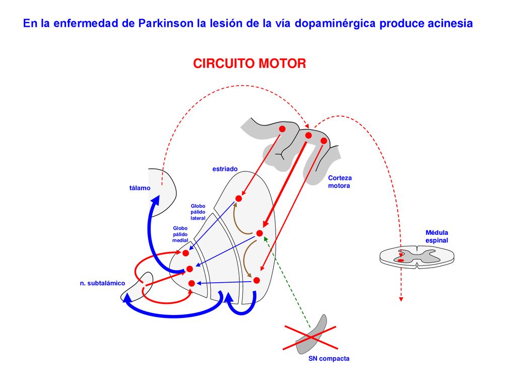 En la enfermedad de Parkinson la lesión de la vía dopaminérgica produce acinesia