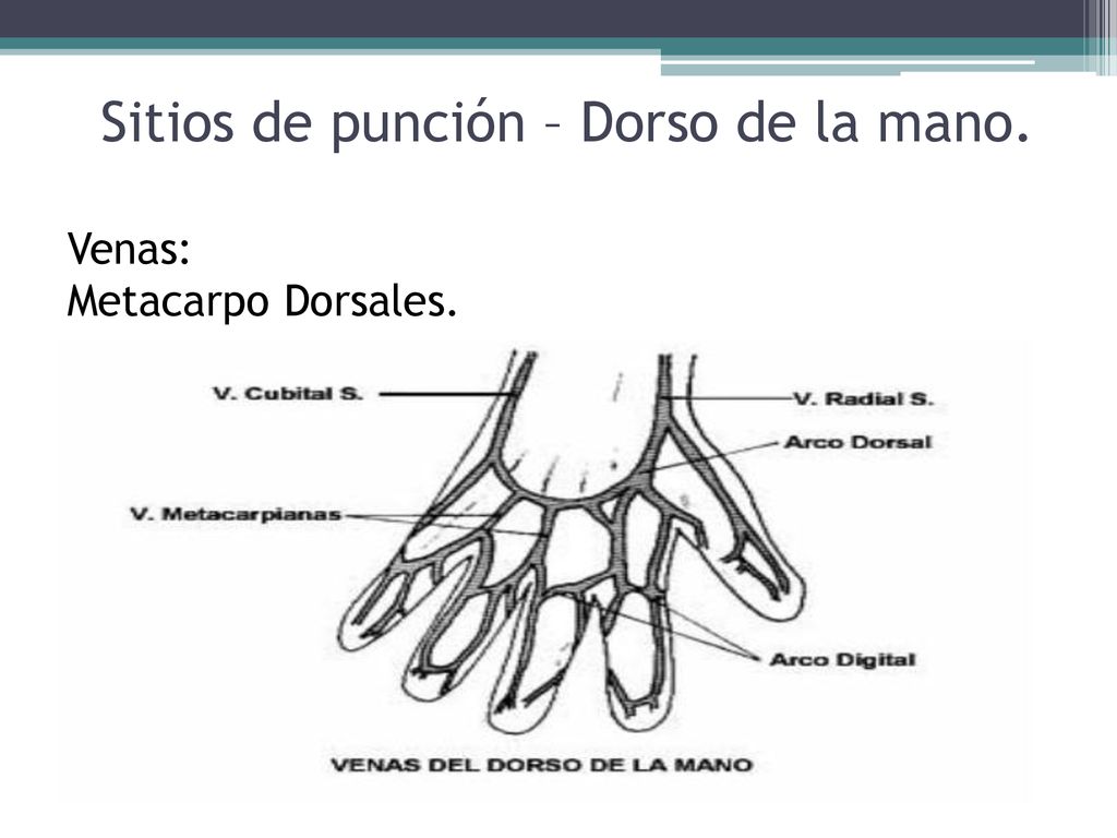 Sitios de punción – Dorso de la mano. Venas: Metacarpo Dorsales.