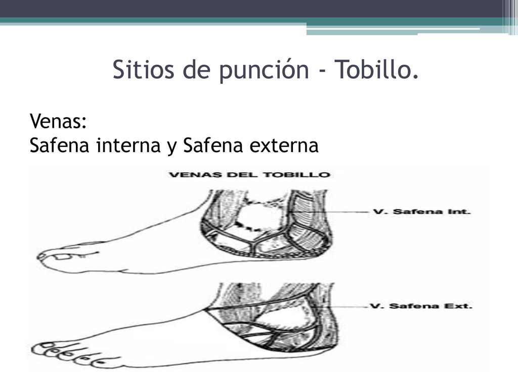 Sitios de punción - Tobillo. Venas: Safena interna y Safena externa