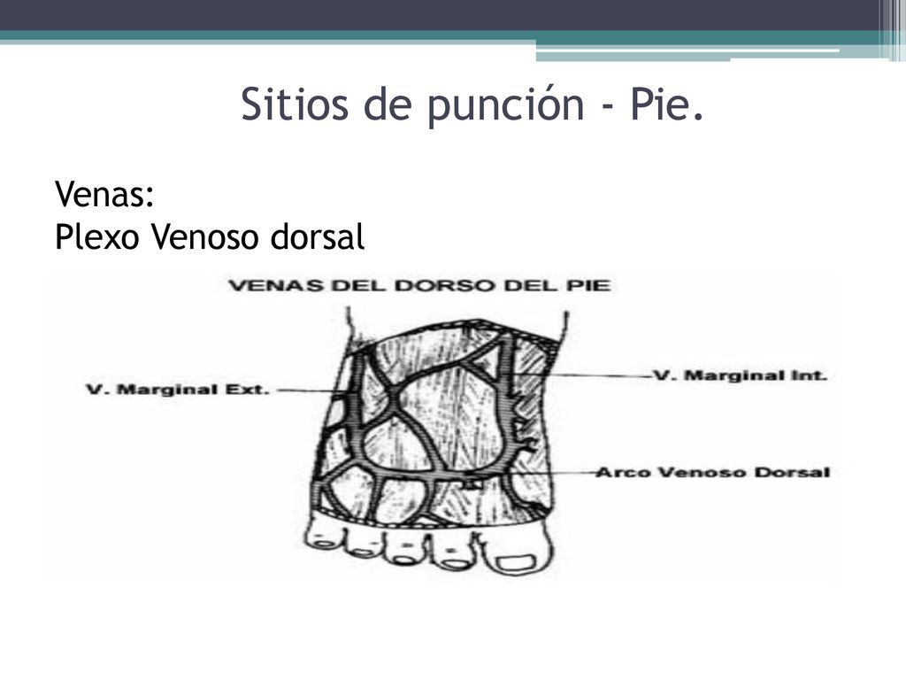 Sitios de punción - Pie. Venas: Plexo Venoso dorsal