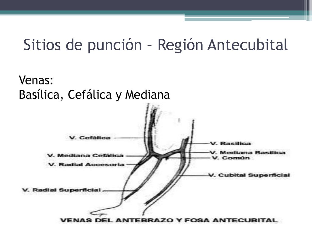 Sitios de punción – Región Antecubital Venas: Basílica, Cefálica y Mediana