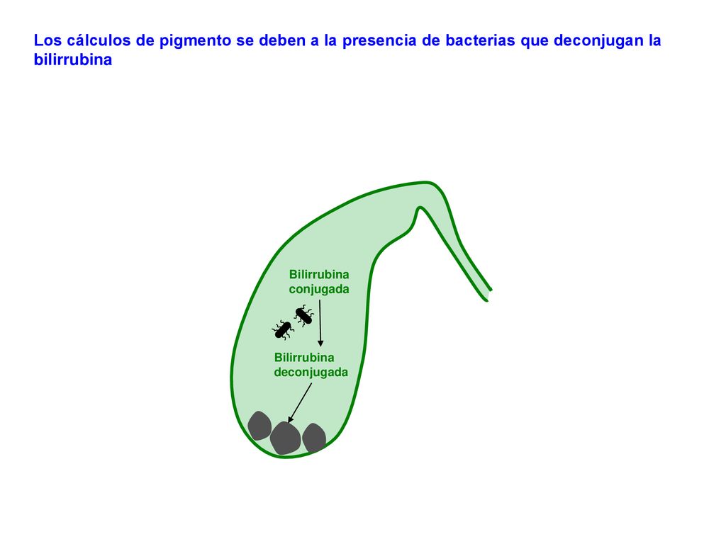 Los cálculos de pigmento se deben a la presencia de bacterias que deconjugan la bilirrubina