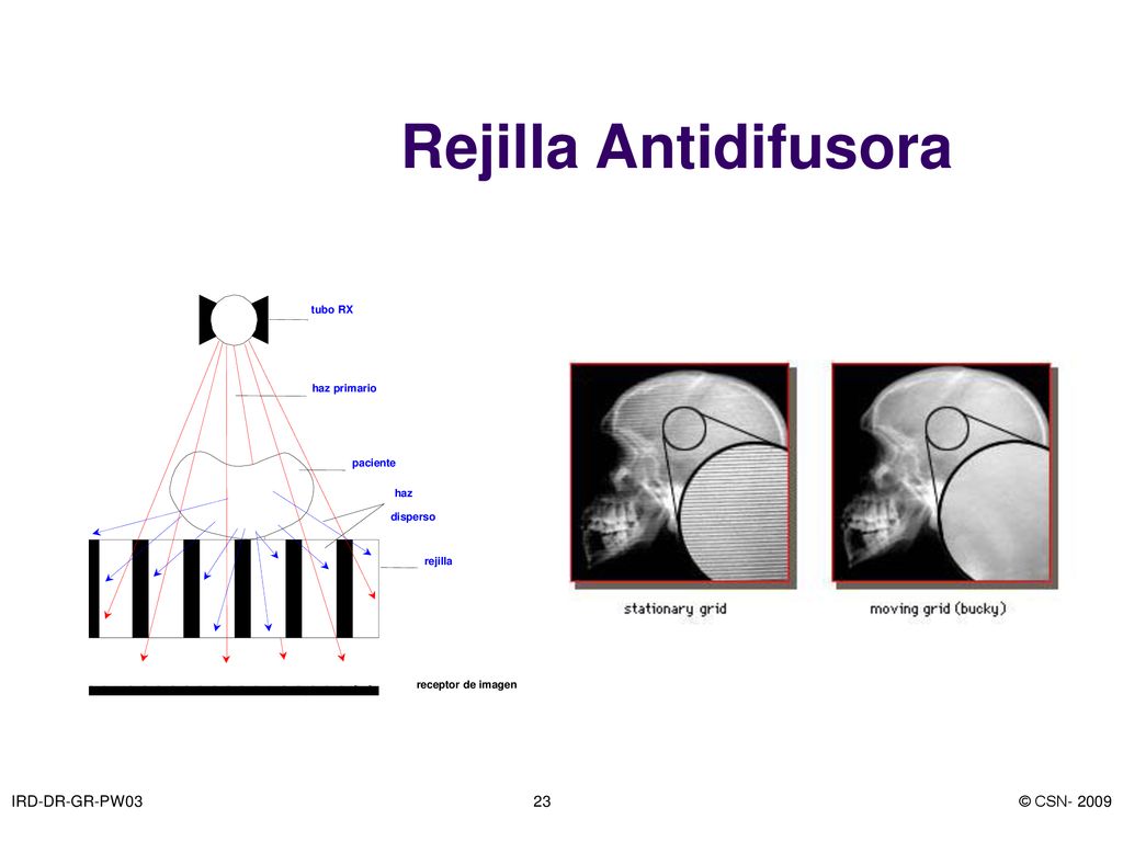 Rejilla Antidifusora IRD-DR-GR-PW03 © CSN tubo RX haz primario