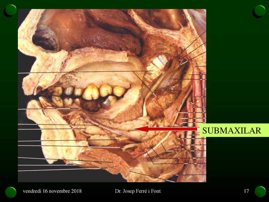 SUBMAXILAR vendredi 16 novembre 2018 Dr. Josep Ferré i Font