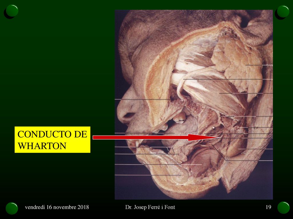 CONDUCTO DE WHARTON vendredi 16 novembre 2018 Dr. Josep Ferré i Font