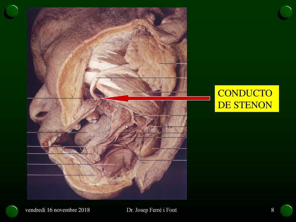 CONDUCTO DE STENON vendredi 16 novembre 2018 Dr. Josep Ferré i Font