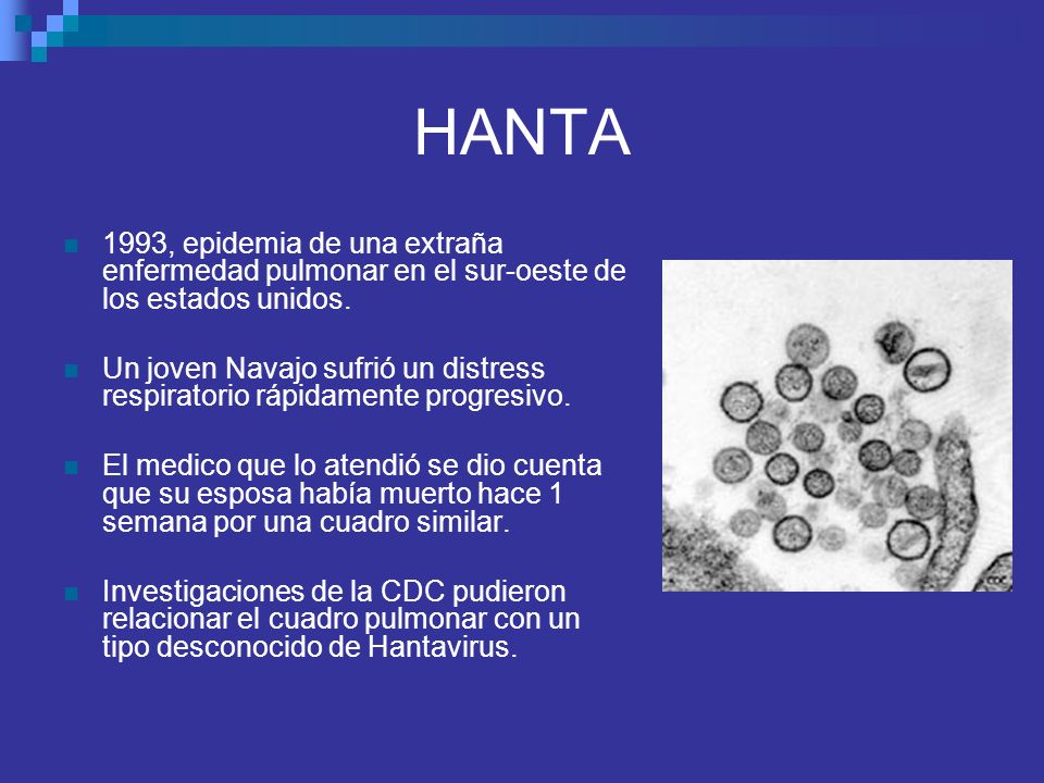 HANTA 1993, epidemia de una extraña enfermedad pulmonar en el sur-oeste de los estados unidos.
