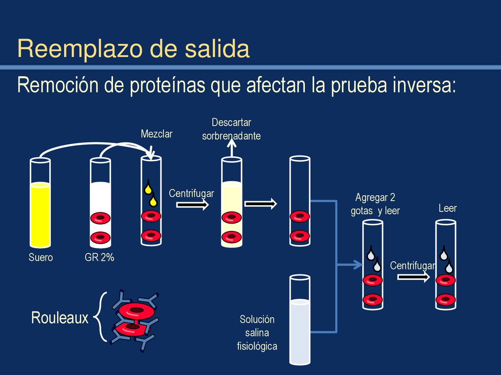 Reemplazo de salida Remoción de proteínas que afectan la prueba inversa: Descartar sorbrenadante. Suero.
