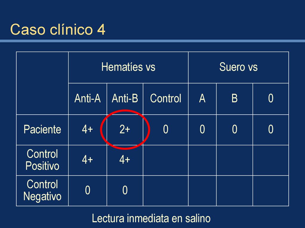 Caso clínico 4 Hematíes vs Suero vs Anti-A Anti-B Control A B Paciente