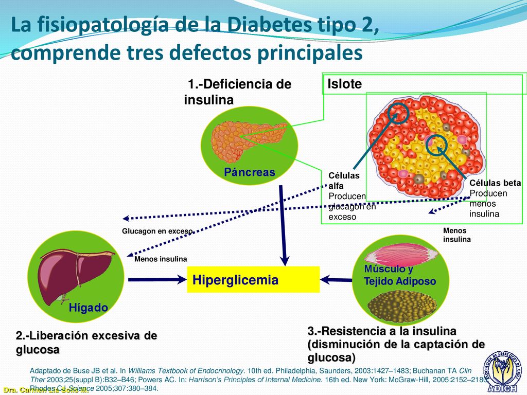 La fisiopatología de la Diabetes tipo 2, comprende tres defectos principales