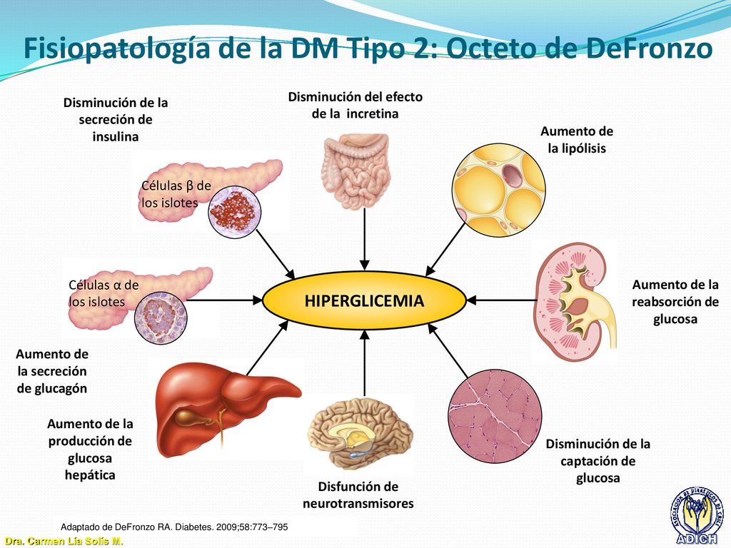 Fisiopatología de la DM Tipo 2: Octeto de DeFronzo
