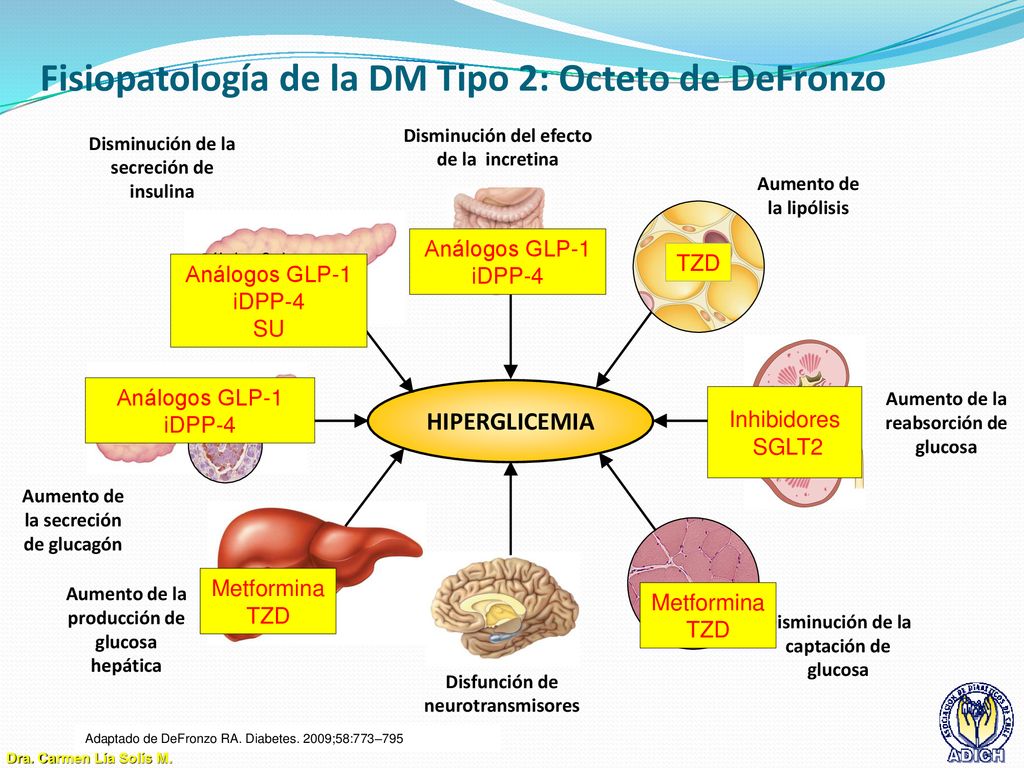 Fisiopatología de la DM Tipo 2: Octeto de DeFronzo